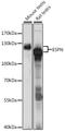 Espin antibody, A15908, ABclonal Technology, Western Blot image 