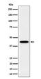 Inositol-tetrakisphosphate 1-kinase antibody, M09106-1, Boster Biological Technology, Western Blot image 