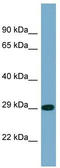Protein Phosphatase 2 Catalytic Subunit Alpha antibody, TA335806, Origene, Western Blot image 