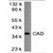 DNA fragmentation factor subunit beta antibody, LS-C282, Lifespan Biosciences, Western Blot image 