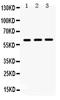 Hnf-1b antibody, PB9597, Boster Biological Technology, Western Blot image 