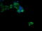 B- and T-lymphocyte attenuator antibody, M03149-1, Boster Biological Technology, Immunofluorescence image 
