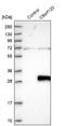 Chromosome 6 Open Reading Frame 120 antibody, NBP1-88979, Novus Biologicals, Western Blot image 