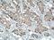 MHC Class I Polypeptide-Related Sequence B antibody, 14325-1-AP, Proteintech Group, Immunohistochemistry frozen image 