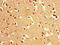 P21 (RAC1) Activated Kinase 3 antibody, CSB-PA017407LA01HU, Cusabio, Immunohistochemistry paraffin image 