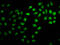 Zinc Finger Protein 224 antibody, LS-C681741, Lifespan Biosciences, Immunofluorescence image 