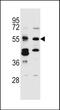 CUGBP Elav-Like Family Member 3 antibody, PA5-48508, Invitrogen Antibodies, Western Blot image 