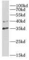 NF-kappa-B inhibitor alpha antibody, FNab04198, FineTest, Western Blot image 