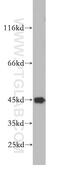 Serpin Family B Member 12 antibody, 21289-1-AP, Proteintech Group, Western Blot image 