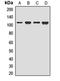 Discoidin Domain Receptor Tyrosine Kinase 2 antibody, orb411658, Biorbyt, Western Blot image 