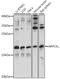 Actin Related Protein 2/3 Complex Subunit 5 Like antibody, 16-314, ProSci, Western Blot image 