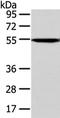 Calcium/Calmodulin Dependent Protein Kinase IG antibody, TA321879, Origene, Western Blot image 