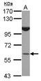 BTB Domain Containing 16 antibody, LS-C155625, Lifespan Biosciences, Western Blot image 