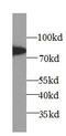 Arachidonate 5-lipoxygenase antibody, FNab00007, FineTest, Western Blot image 