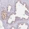 Solute carrier family 17 member 9 antibody, PA5-63312, Invitrogen Antibodies, Immunohistochemistry paraffin image 