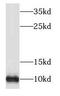 NADH:Ubiquinone Oxidoreductase Subunit V3 antibody, FNab05637, FineTest, Western Blot image 