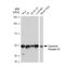 Dopamine Receptor D3 antibody, GTX02836, GeneTex, Western Blot image 