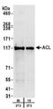 ATP Citrate Lyase antibody, A303-866A, Bethyl Labs, Western Blot image 