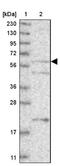 E3 ubiquitin-protein ligase RNF220 antibody, NBP1-88487, Novus Biologicals, Western Blot image 