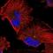 Regulator of microtubule dynamics protein 1 antibody, NBP1-88089, Novus Biologicals, Immunocytochemistry image 