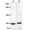 Actinin Alpha 1 antibody, GTX57633, GeneTex, Western Blot image 