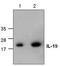 Interleukin 19 antibody, TA319096, Origene, Western Blot image 