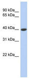 Carboxypeptidase B1 antibody, TA334670, Origene, Western Blot image 