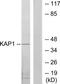 KAP1 antibody, TA312036, Origene, Western Blot image 