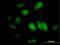 GTP Binding Protein 4 antibody, H00023560-B01P, Novus Biologicals, Immunocytochemistry image 