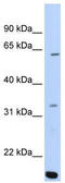 AT-Rich Interaction Domain 5A antibody, TA339850, Origene, Western Blot image 