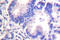 SNCG antibody, LS-C176305, Lifespan Biosciences, Immunohistochemistry paraffin image 