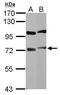 Cytoplasmic dynein 1 intermediate chain 1 antibody, GTX112418, GeneTex, Western Blot image 
