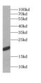 Chromosome 10 Open Reading Frame 67 antibody, FNab01000, FineTest, Western Blot image 