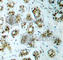p65 antibody, AP0445, ABclonal Technology, Immunofluorescence image 
