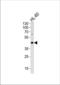 ADA1 antibody, TA324419, Origene, Western Blot image 