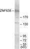 Zinc Finger Protein 638 antibody, EKC1812, Boster Biological Technology, Western Blot image 