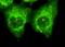 Arrestin Beta 2 antibody, M01443, Boster Biological Technology, Immunofluorescence image 