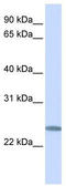 Chromosome 12 Open Reading Frame 49 antibody, TA338672, Origene, Western Blot image 