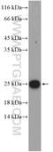VHL Binding Protein 1 antibody, 14345-1-AP, Proteintech Group, Western Blot image 