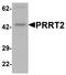 Proline Rich Transmembrane Protein 2 antibody, LS-B10096, Lifespan Biosciences, Western Blot image 