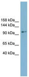 Cyclin And CBS Domain Divalent Metal Cation Transport Mediator 2 antibody, TA342032, Origene, Western Blot image 