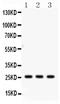 Surfactant Protein A2 antibody, PB9390, Boster Biological Technology, Western Blot image 