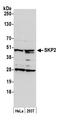 S-Phase Kinase Associated Protein 2 antibody, A302-436A, Bethyl Labs, Western Blot image 