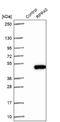 Ribonuclease P/MRP Subunit P40 antibody, NBP1-88765, Novus Biologicals, Western Blot image 