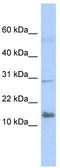 Interferon Alpha Inducible Protein 27 Like 2 antibody, TA339595, Origene, Western Blot image 