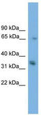 Phospholipid Phosphatase 1 antibody, TA346362, Origene, Western Blot image 