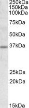 Uncoupling Protein 2 antibody, LS-B3249, Lifespan Biosciences, Western Blot image 