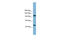 Protein SMG8 antibody, ARP57129_P050, Aviva Systems Biology, Western Blot image 