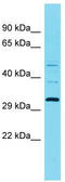 Protein RGD1309748 antibody, TA332199, Origene, Western Blot image 