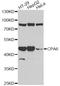 Carboxypeptidase A6 antibody, A13644, ABclonal Technology, Western Blot image 